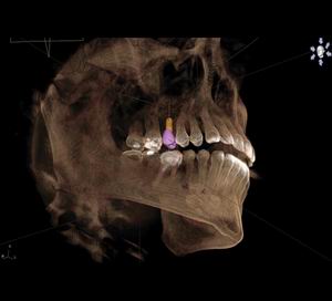 3D CT Scan x-rays in-clinic